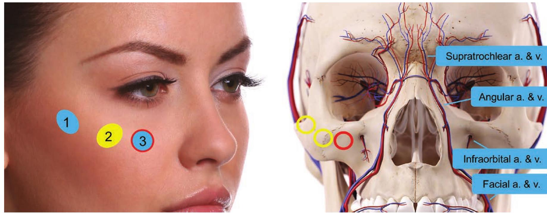(PDF) Facial Assessment and Injection Guide