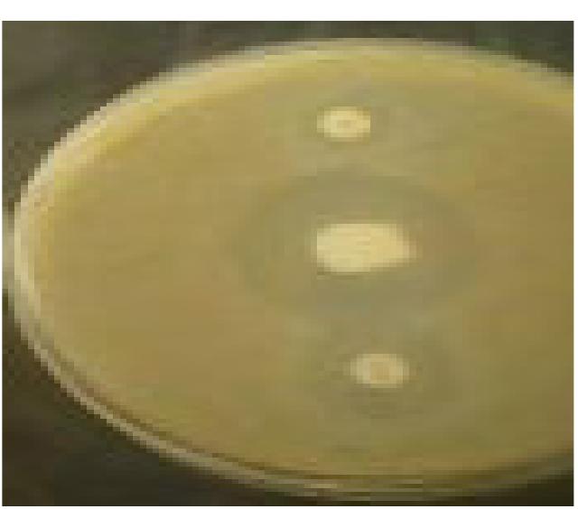 (PDF) Effectiveness of Double Discs Synergy Test in the Confirmation of ...