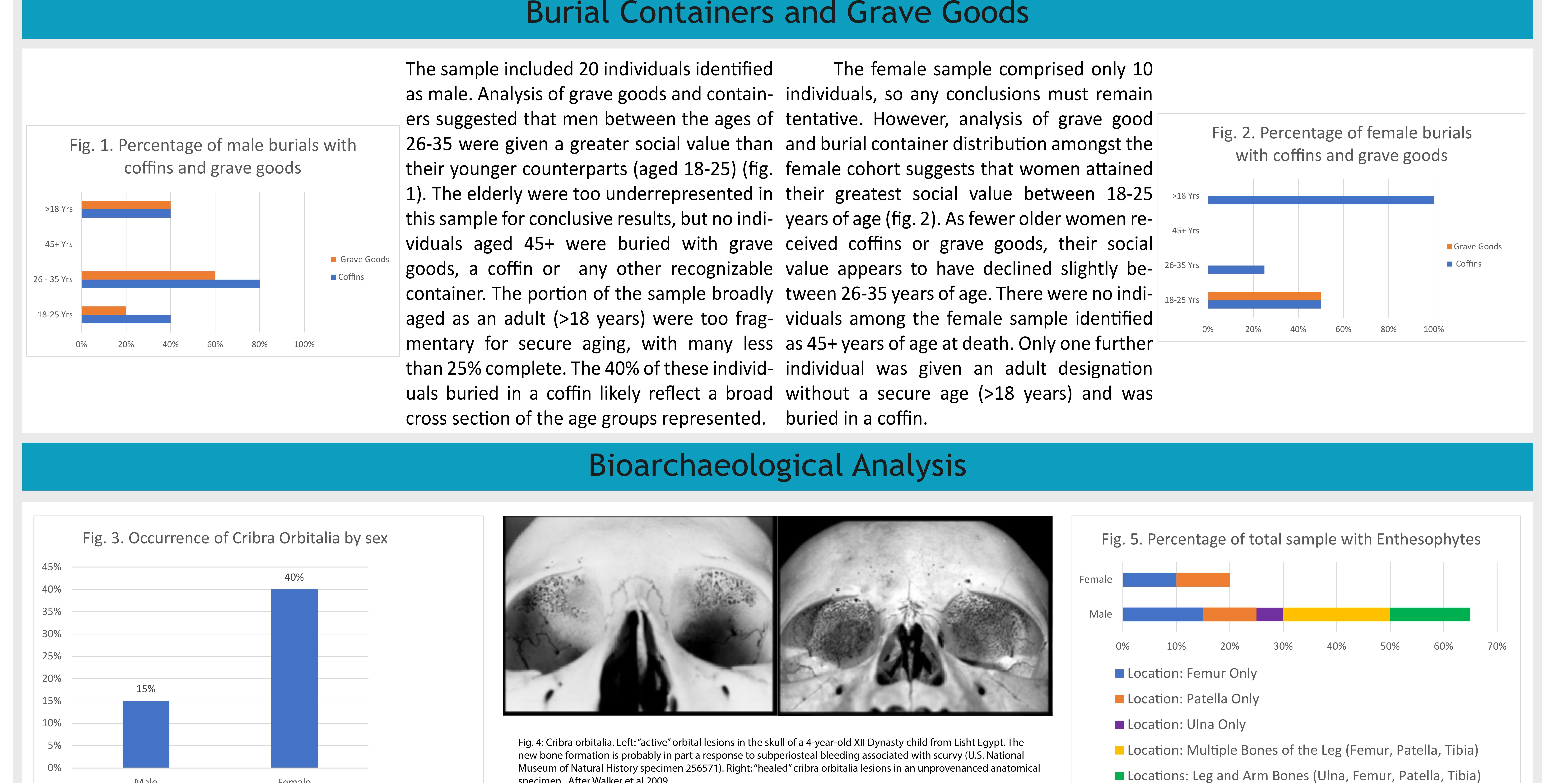 The osteological analysis of this sample suggests differing occupation and health statuses between the male and female inhabitants of Roman Gloucester. For instance, women were 2.6 times more likely to have cribra orbitalia —porotic lesions of the orbital roofs — which have been tradi- tionally associated with iron-deficiency anaemia (though more recently connected with haemolytic and megaloblas- tic anaemias (Walker et al 2009)) (fig. 3). Whether this pa- thology was primarily caused by sex- or status-based dietary and/or environmental differences is unclear, but may be  subject to further research.  Conversely, men were 3.25 times more likely to have enthesophytes — abnormal bony projections at the at- — tachment of a tendon or ligament caused by stress — than | women (fig. 5). Furthermore, the enthesophytes present on the remains were distributed more equally between the upper and lower limbs for men than they were for women. This suggests that men and women experienced differing types of physical stress. It is also possible that men began to experience this physical stress earlier than their female  Recent research has increasingly empha- sised the Roman life-course and gendered experience. However, existing studies tend to be of limited scope, often utilizing only a single form of evidence e.g. burial goods or epitaphs, to divide lived experience by sex, age, and variable social events (such as mar- riage) (Revell 2005; Harlow and Laurence 2002). As a result, research into the adult  life-course has focused primarily on the el- derly or on young adult women; the remain- ing years of adulthood appear as a monolith- ic unit covered without sufficient detail (Gowland 2015; Alberici and Harlow 2007). This poster problematizes the treatment of the adult life course and presents a new methodology aimed at readdressing the bal- ance in Roman gender and age studies.  counterparts — 33% of the male sample between the ages of 18-25 presented with enthesophytes, but no women under _ the age of 25 are recorded as having enthesophytes, though this may also result from the small sample size (fig. 5). The relation between physical stress and the social status of the inhabitants of Roman Gloucester is unclear, but it seems likely that some of the individuals with enthesophytes were ~ engaged in manual labour related to farming or industry.  Glevum (Colonia Nervia Glevensium) was venience), 30 of whom were securely sexed. initially founded as a Roman fort at King- While small, this sample is sufficient to sholm. The site later became a legionary demonstrate how multiple types of data can colony in AD 97. The cemetery at 120-122 be used to construct a more complete London Road, Gloucester (Simmonds et al. life-course for specific settlements, settle- 2008) was chosen as a test case due to the ment types, or regions.  high-quality of published data, including  bioarchaeological findings. This study will  focus on the 63 adults (i.e. aged 18+ for con- 
