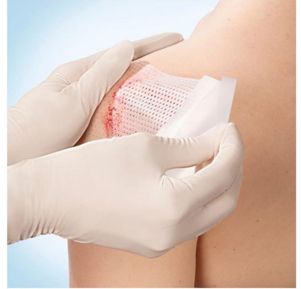 (PDF) A Thoroughgoing Detail of Surgical Dressings