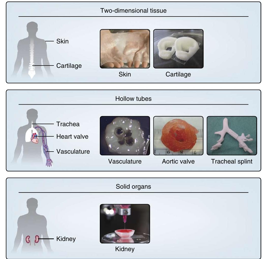 Figure 3 - 3D bioprinting of tissues and organs