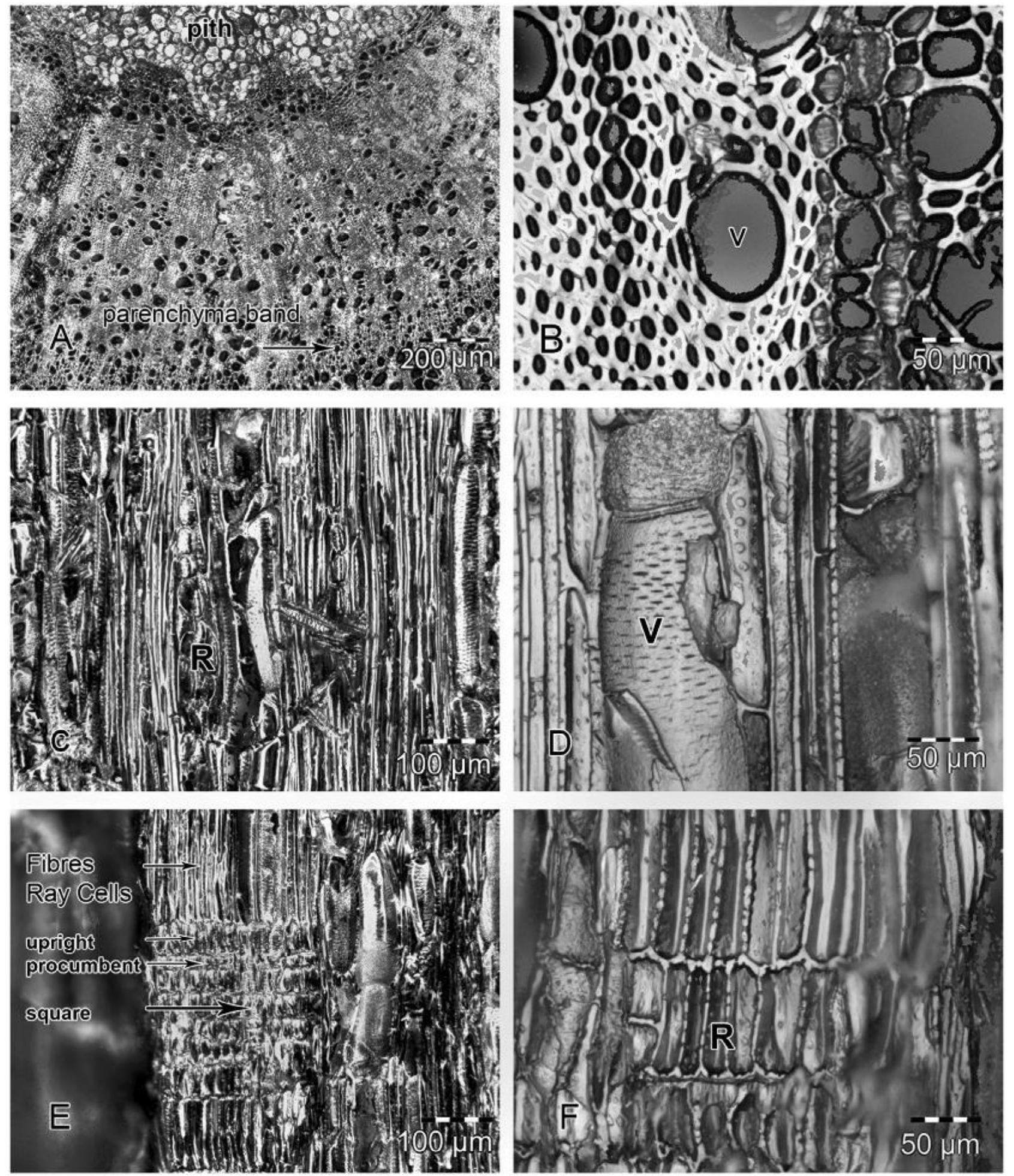 Figure 12 - from Identifying Asteraceae, particularly