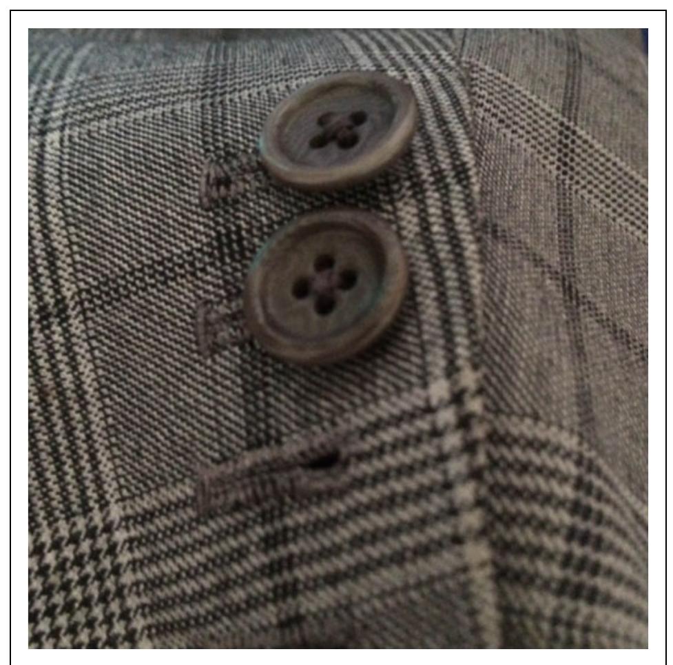 Figure 4. Kanwar’s surgeon cuffs on his bespoke suit jacket. 