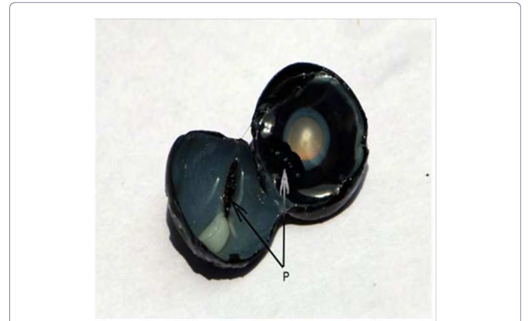 Pecten Eye (PDF) Gross, Histomorphological, Histochemical and Ultrastructural ...