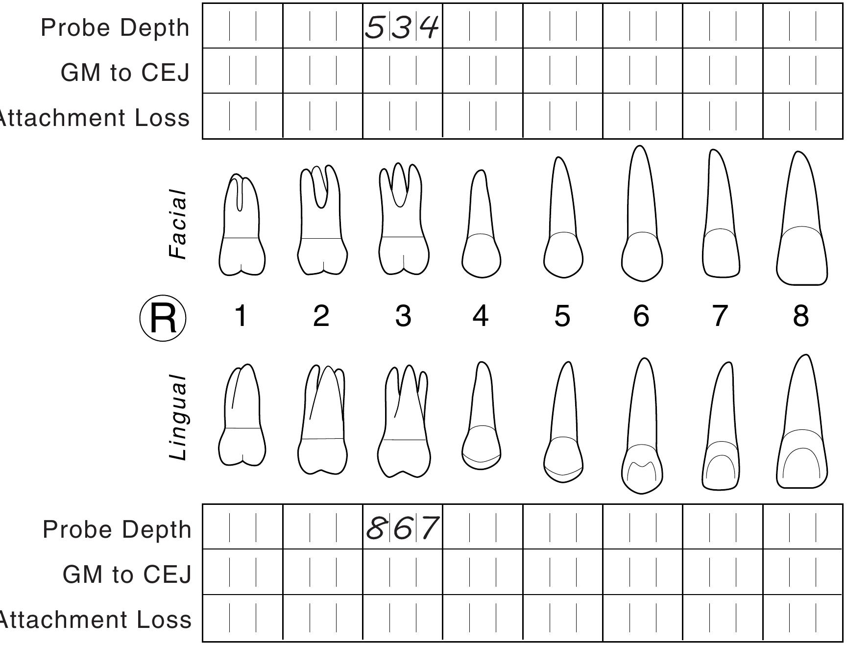 pdf-calibrated-periodontal-probes-and-basic-probing-technique for Free Printable Perio Charting Form PDF) Calibrated Periodontal Probes and Basic Probing Technique for Free Printable Perio Charting Form
