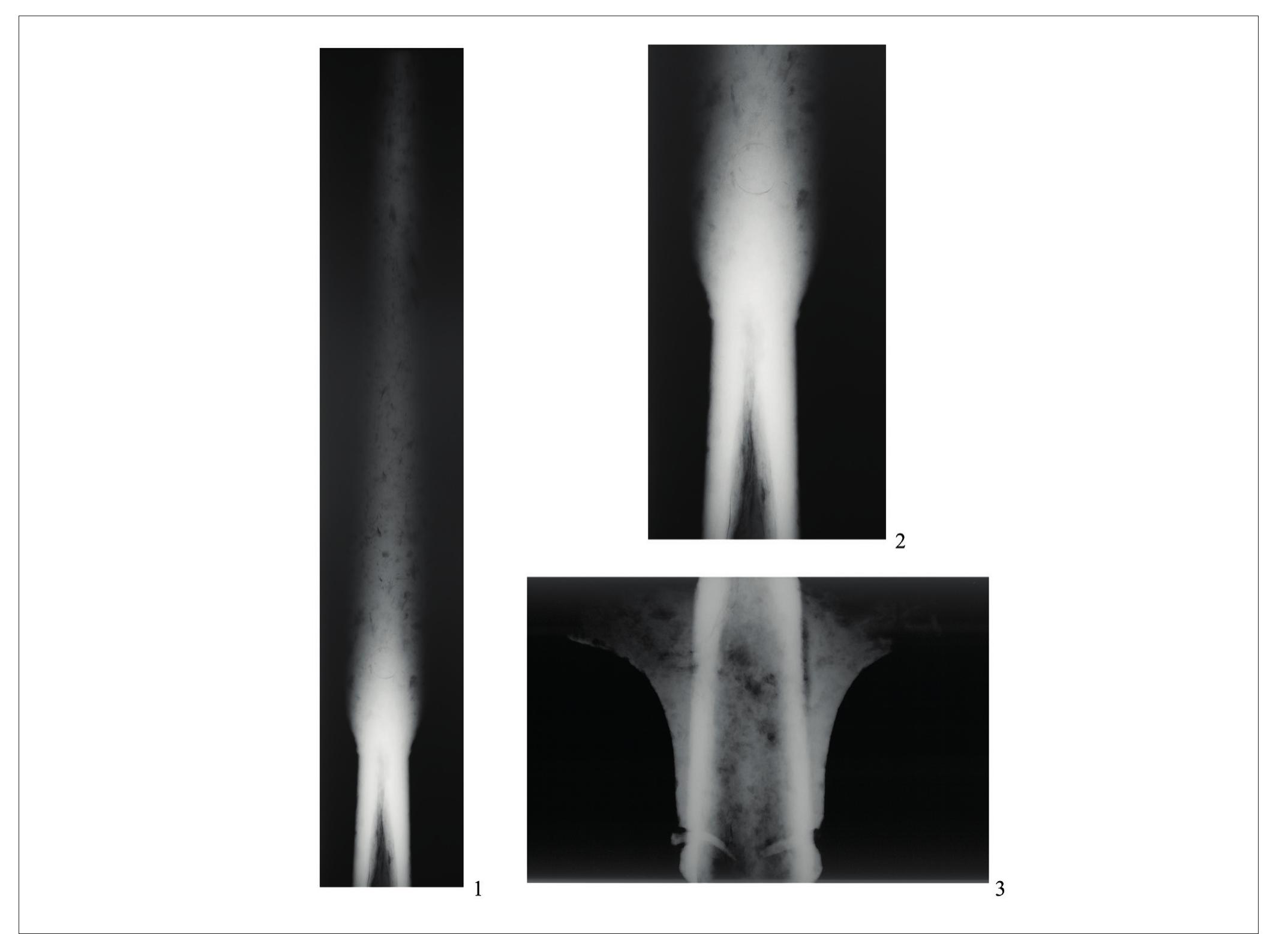 PLATE 4. Winged spearhead from Fruska Gora, radiographs (The Medieval Collection of the Archaeological Museum in Zagreb, S-4120; photo by D. Dora¢éic¢). 