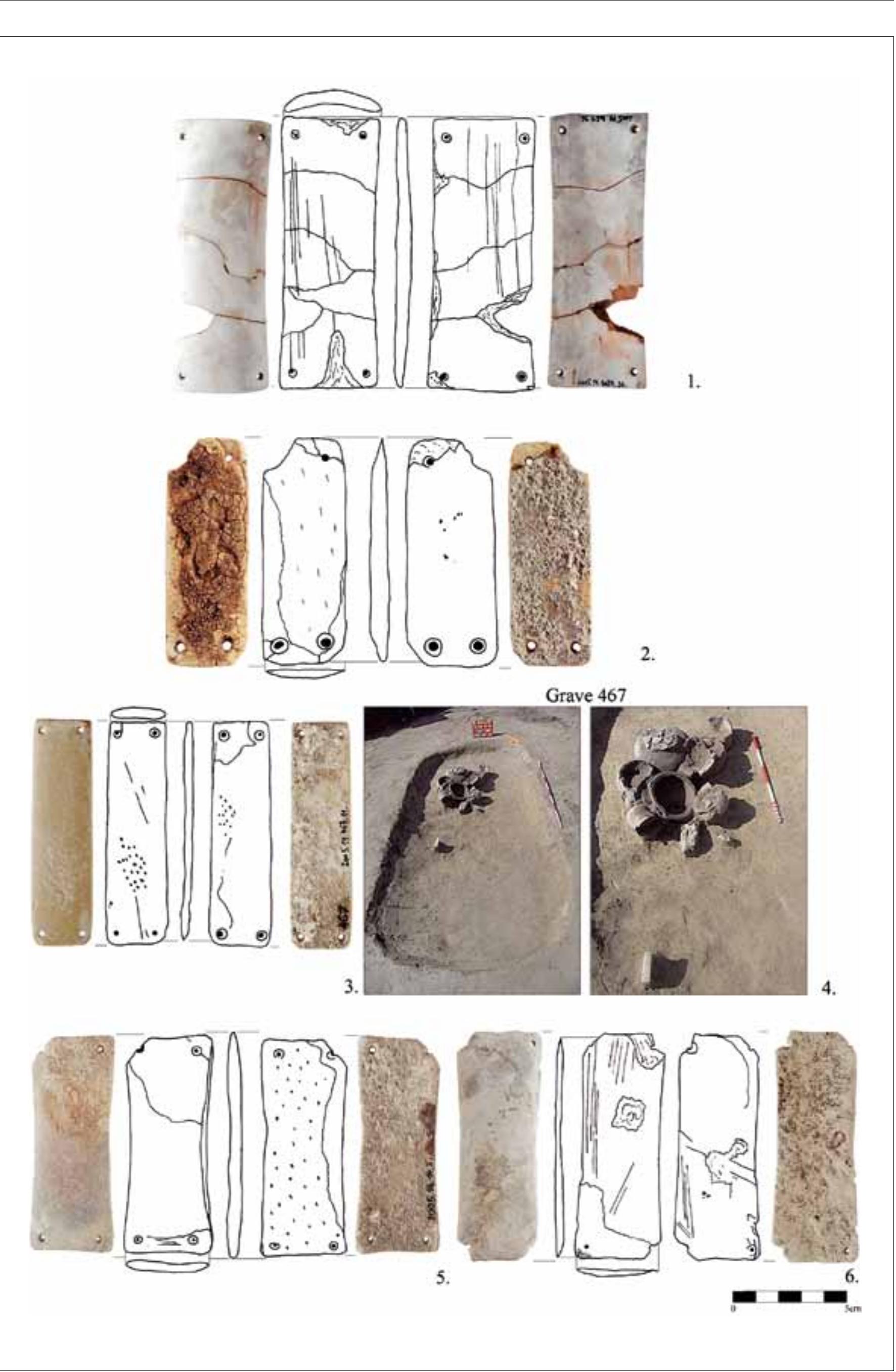 Fig. 6. Wrist-guards. 