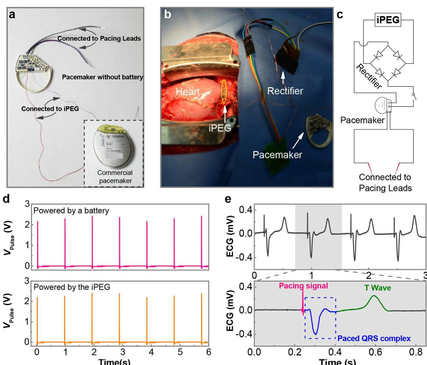 (PDF) Direct Powering a Real Cardiac Pacemaker by Natural Energy of a ...