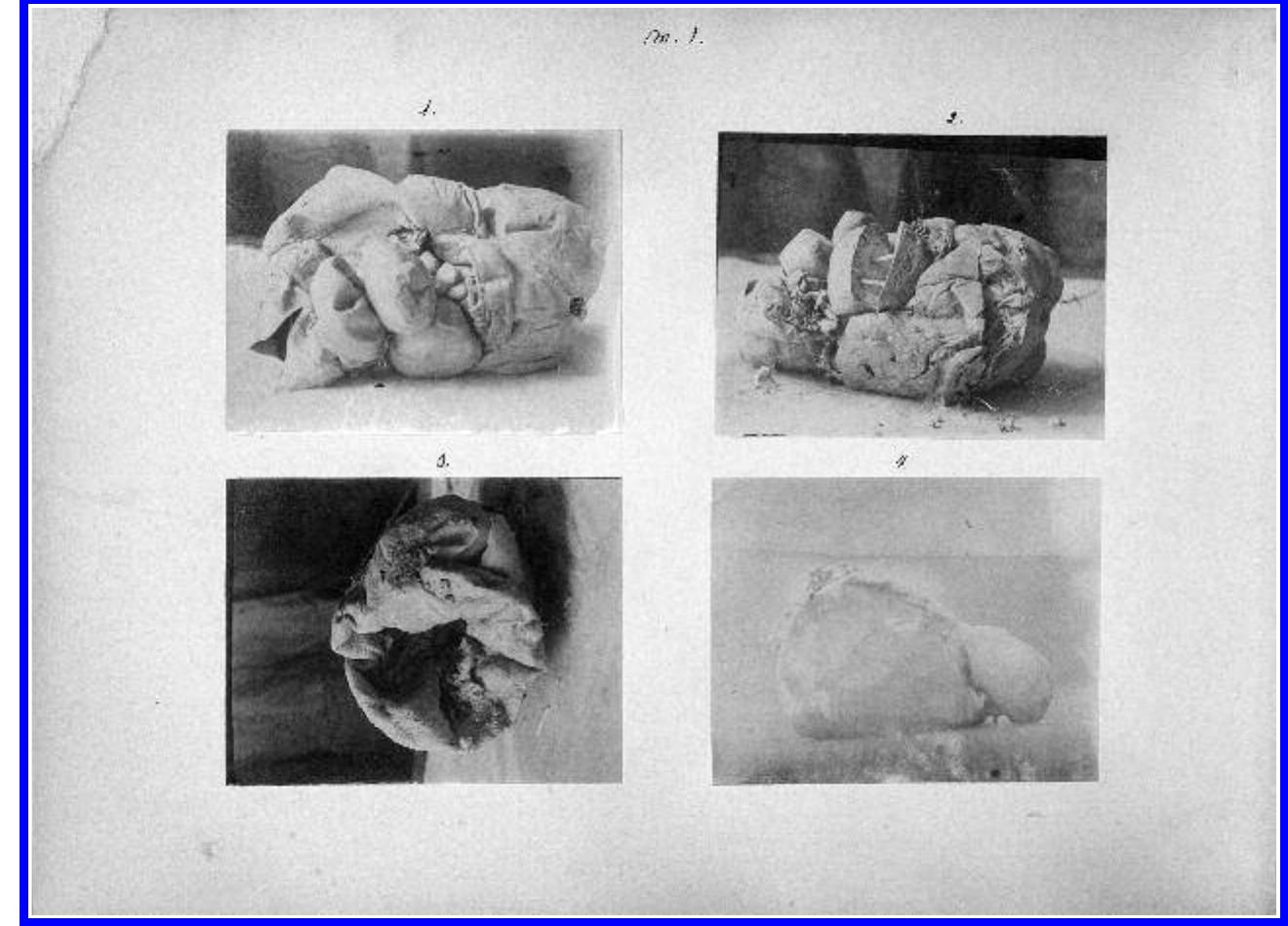 The existence of a second album with significant differences from the album sent to Yildiz Palace proves that the palace album (full of “pic- tures of health” that visualize care and captions that underscore healing  and recovery) was de  iberately constructed for the sultan. The Haseki  portrait album is undated but was likely produced between the time of  Nurettin’s arrival at t perhaps before the n  he hospital in 1890 and his departure in 1894— ew pavilions opened in 1893, when it became  possible to photograph patients in the hospital.  a 7 a | 1 