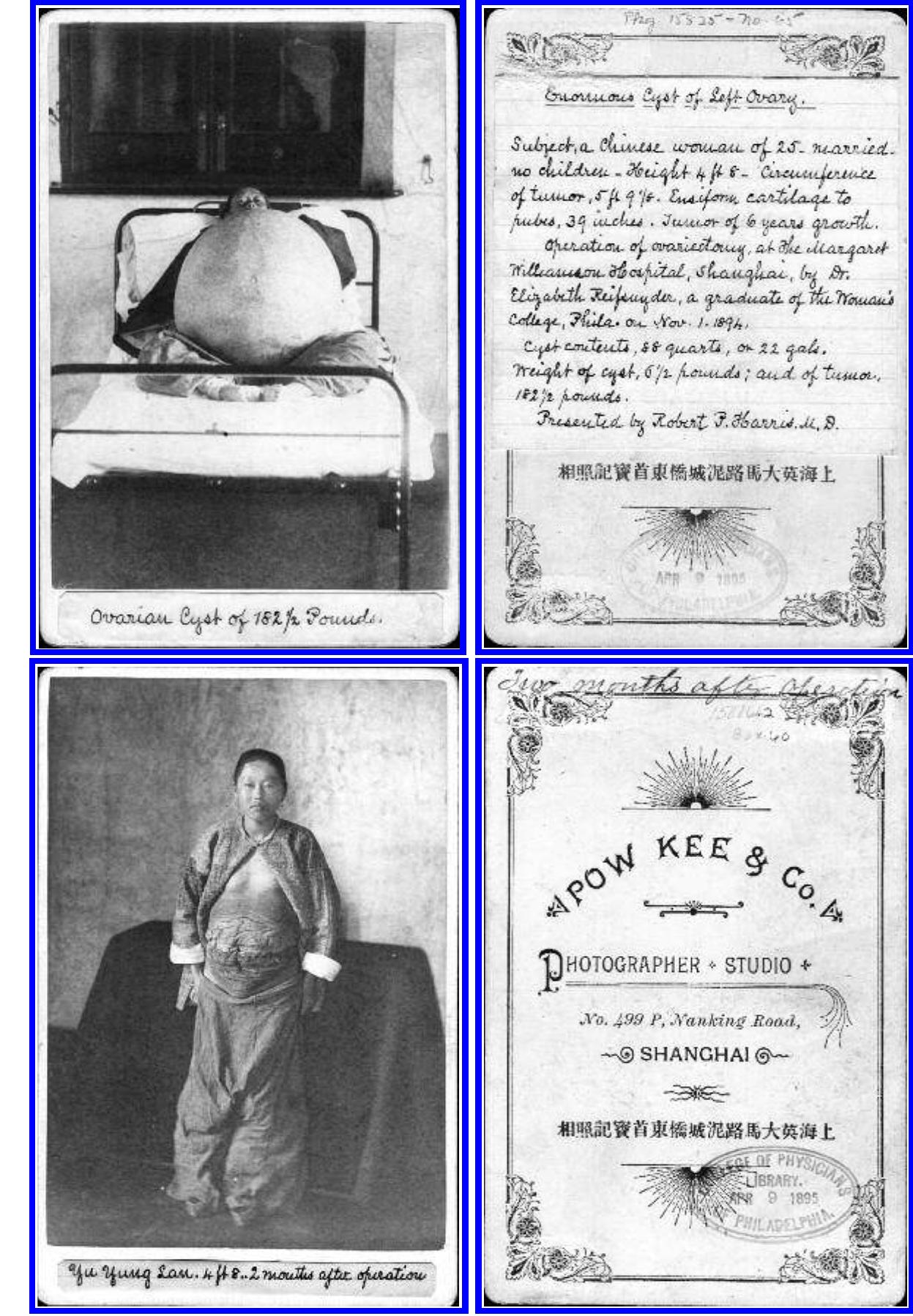 Returning to the Haseki portrait album, I wondered how we might make sense of the surgeon’s signature on each plate (and also on each abdomen in the form of a scar), despite the images having been made by a prominent studio photographer? How does this album ask us to rethink agency in photography? The examples from St. Petersburg and Shanghai 