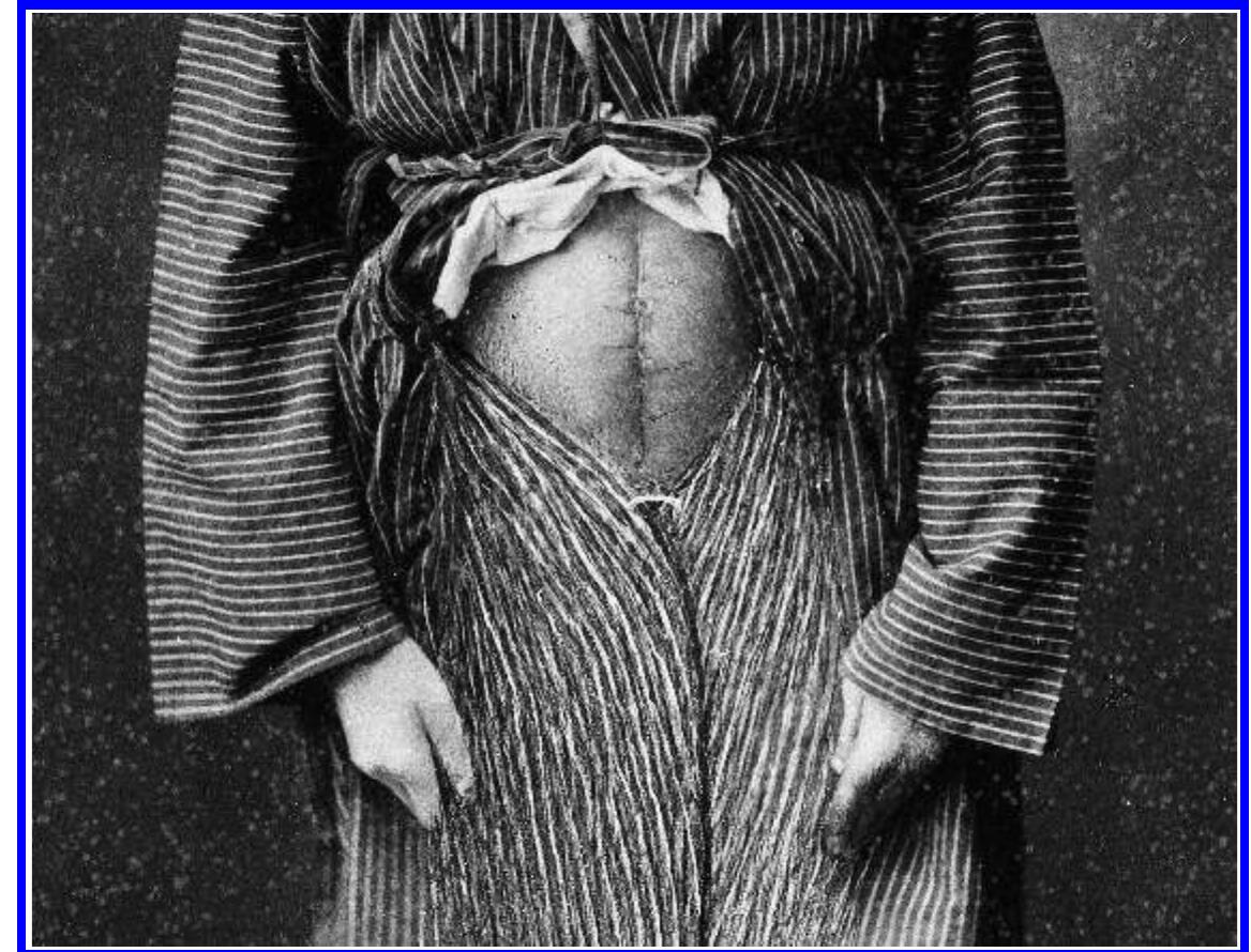 Frustrated that I did not know the date of the clerk’s wife dying in childbirth or the date on which the clerk brought charges of malpractice against Nurettin, I looked at the photograph for anything that could be dated. Another visual detail, yet again one that had always been visible, emerged as a Clue. Scars are also time-based media: perhaps a trained eye could read the time since her surgery in the photograph of Gulizar’s scar. I consulted with the oldest gynecologists and obstetricians I could find and asked them to date the women’s surgeries based on how well the scars had healed. In an attempt to make the process easier, I sent digital  