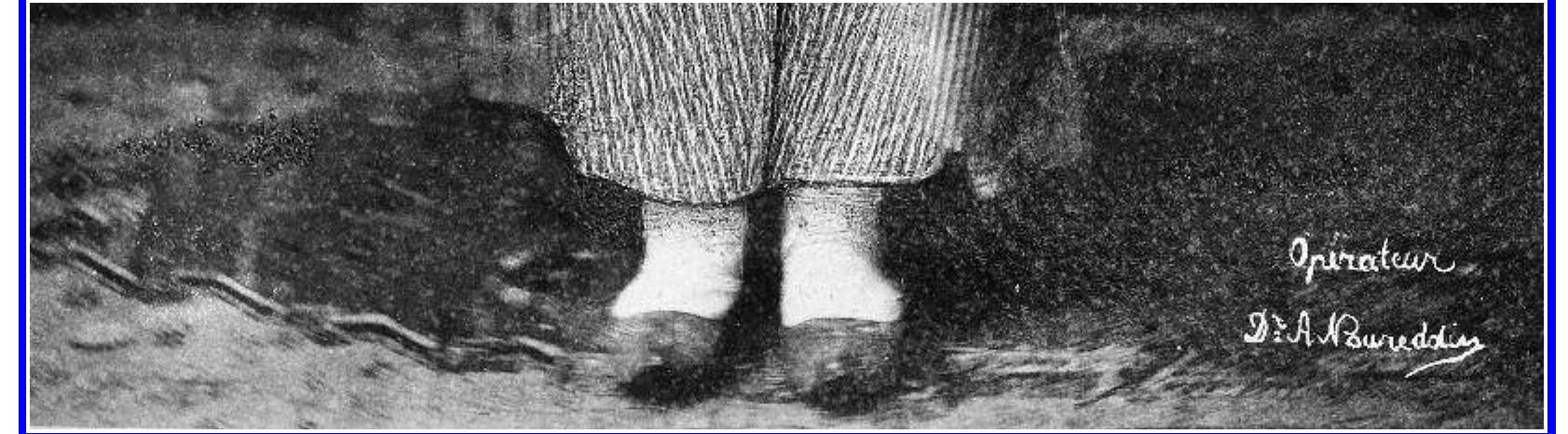 Nicolas Andriomenos or unknown photographer. Gilizar Kadin, 1891. Image 4, Haseki Women’s Hospital album formerly part of Abdilhamid II’s Yildiz Palace collection. Detail. The words “Your servant doctor” were originally etched into the glass plate immediately above Dr. Nurettin’s name but then  painted over. Similarly erased marks to the left of the patient suggest that the original photo- graph was taken not by Nicolas Andriomenos but by another photographer whose name is no longer legible. istanbul Univer- sitesi Nadir Eserler Kitiphanesi (Istanbul University Library of Rare Books).  Nicolas Andriomenos or unknow photographer. Gilizar Kadin, 1891. Image 4, Haseki Women’s Hospital album formerly part of Abdiilhamid II’s Yildiz Palace collection. Detail. The words “Your servant doctor” were originally etched into the glass plate immediately above Dr. Nurettin’s name but then  painted over. Similarly erased marks to the left of the patient suggest that the original photo- graph was taken not by Nicolas Andriomenos but by another photographer whose name is no longer legible. istanbul Univer- sitesi Nadir Eserler Kitiiphanesi (Istanbul University Library of Rare Books). 