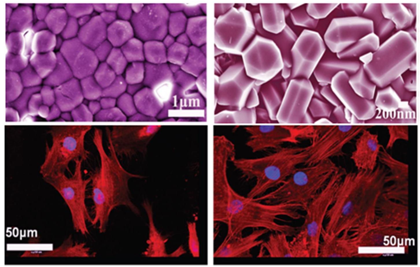 (PDF) Medical Bioceramic Materials