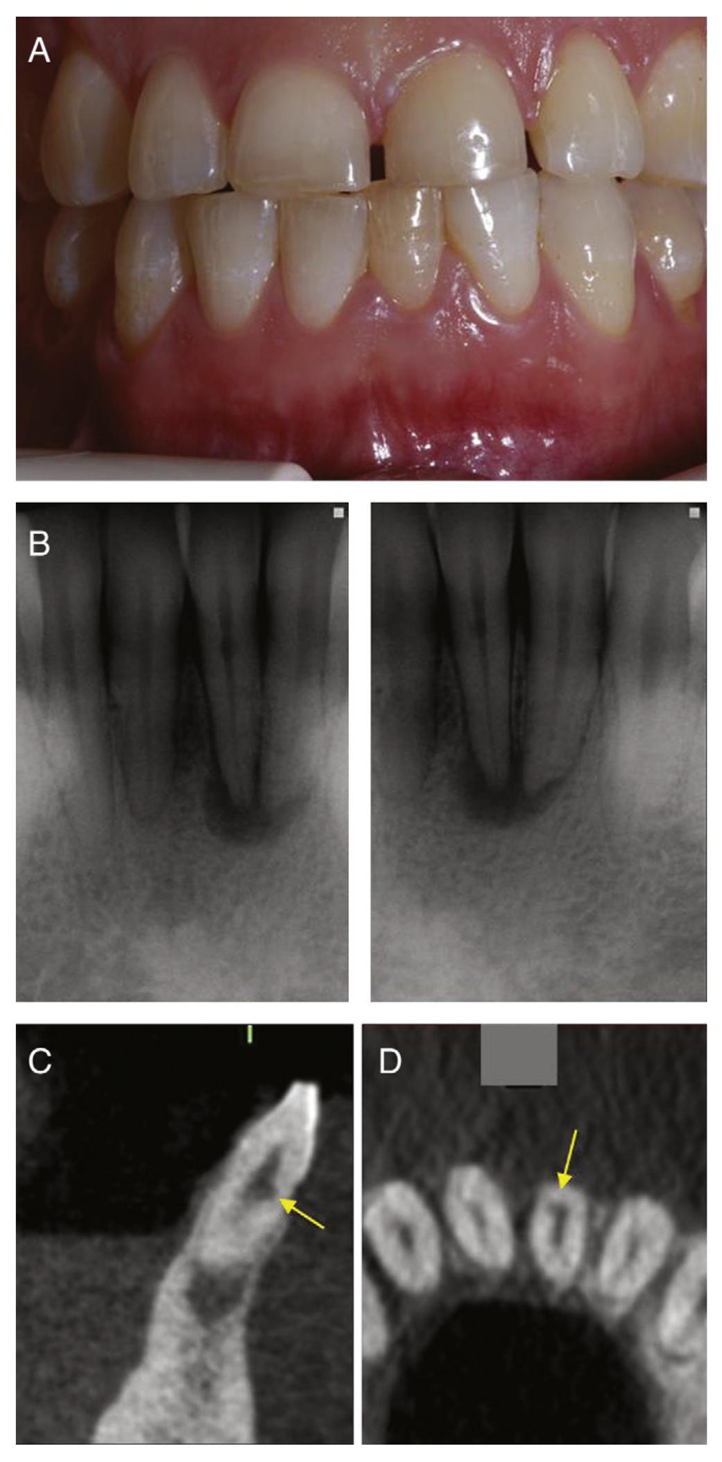 (a) clinical examination reveals that the mandibular left