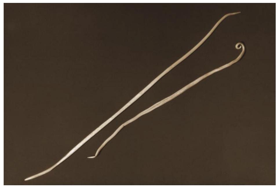 FIGURE 6: ADULT TAPEWORM OF DIPYLIDIUM CANINUM WITH PROGLOTTIDS. SOURCE: HTTPS://UPLOAD.WIKIMEDIA.ORG/ WIKIPEDIA/COMMONS/9/9D/DIPYL_CAN_WORM1,JPG 
