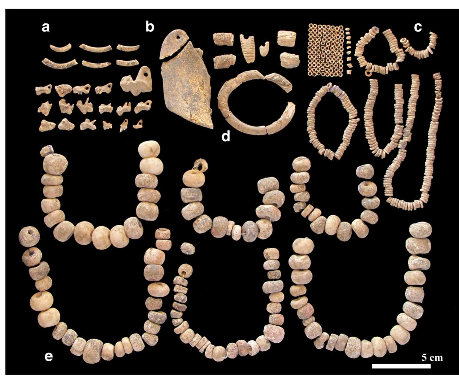the well-preserved right side, may be related to the pattern of greater wear on the right side of the dentition, greater dental calculus on the left side, and asymmetry in the mandibular rami. The right mandibular ramus is more prominently inverted at gonion, with asymmetries extending through the submandibular fossa region (inferior to the mylohyoid line). Other distinguishing features of her skull include four large wormian bones and a notably thin occipital squamous portion which, taken in concert, may suggest a congenital or develop- mental origin for the asymmetry. Facial asymmetry can arise from congenital, developmental, and acquired factors (Thiesen et al. 2015). One possibility in this case is congenital muscular torticollis (wry-neck). Limited ranges of motion and repose can lead to asymmetries of the face and head (Nilesh and Mukherji 2013). Given that she was also relatively tall (~ 170-180 cm, based on estimated maximum femur length, measured in situ), perhaps her appearance and bearing were in some ways linked to her burial treatment.  