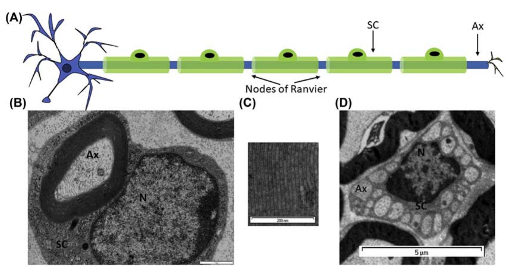 1 structure of axons and schwann cells in the peripheral