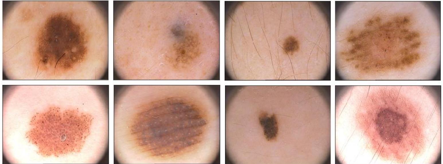 Figure 1 - from Skin Lesion Segmentation using SegNet with