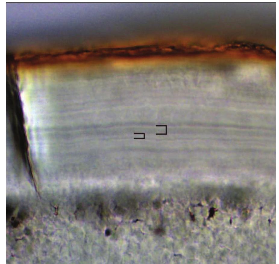 Fig. 2. The tooth cementum band under the micro- scope. The identification and measurement of a tooth cementum layer is illustrated. 