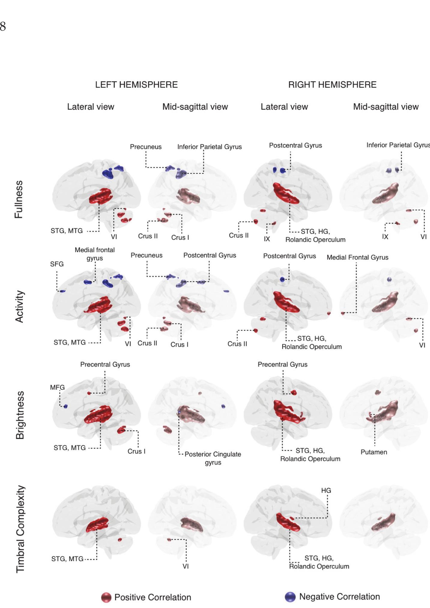 Lateral and mid-sagittal views of the left and right