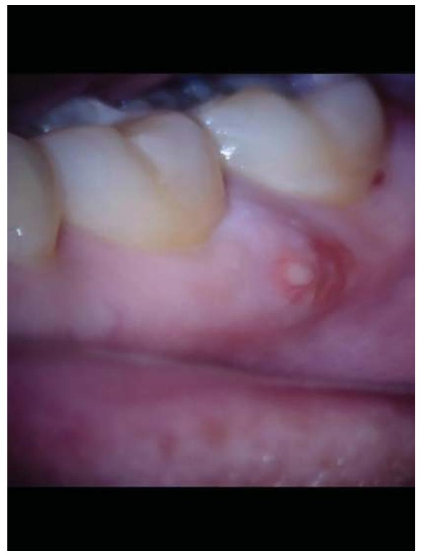 PDF) Current Therapy in Endodontics.PDF