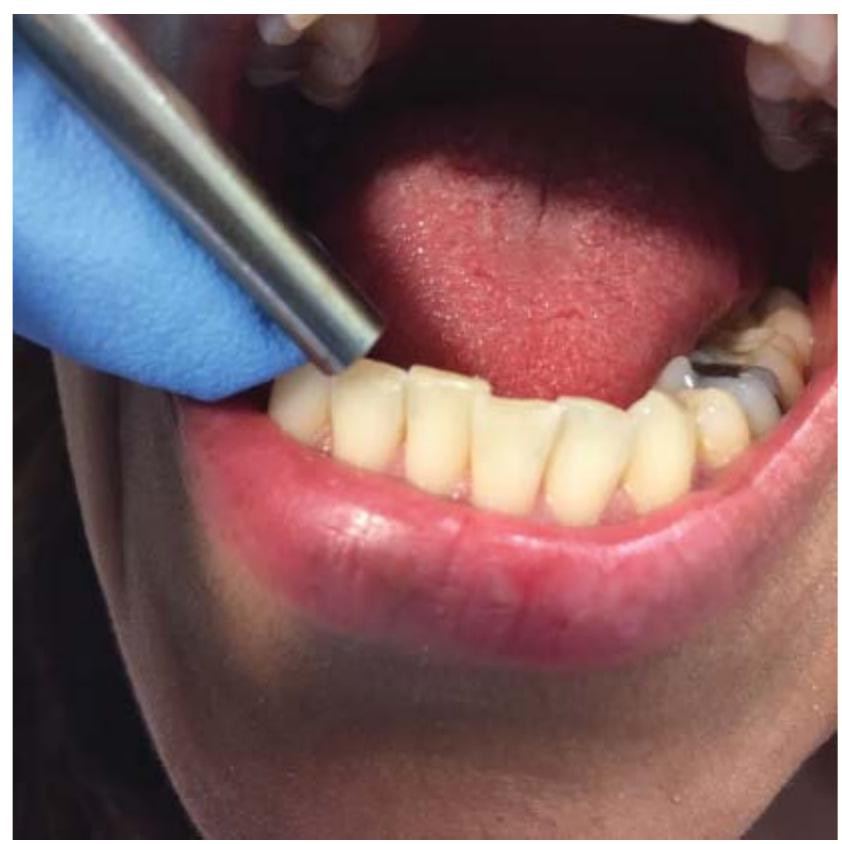 PDF) Current Therapy in Endodontics.PDF