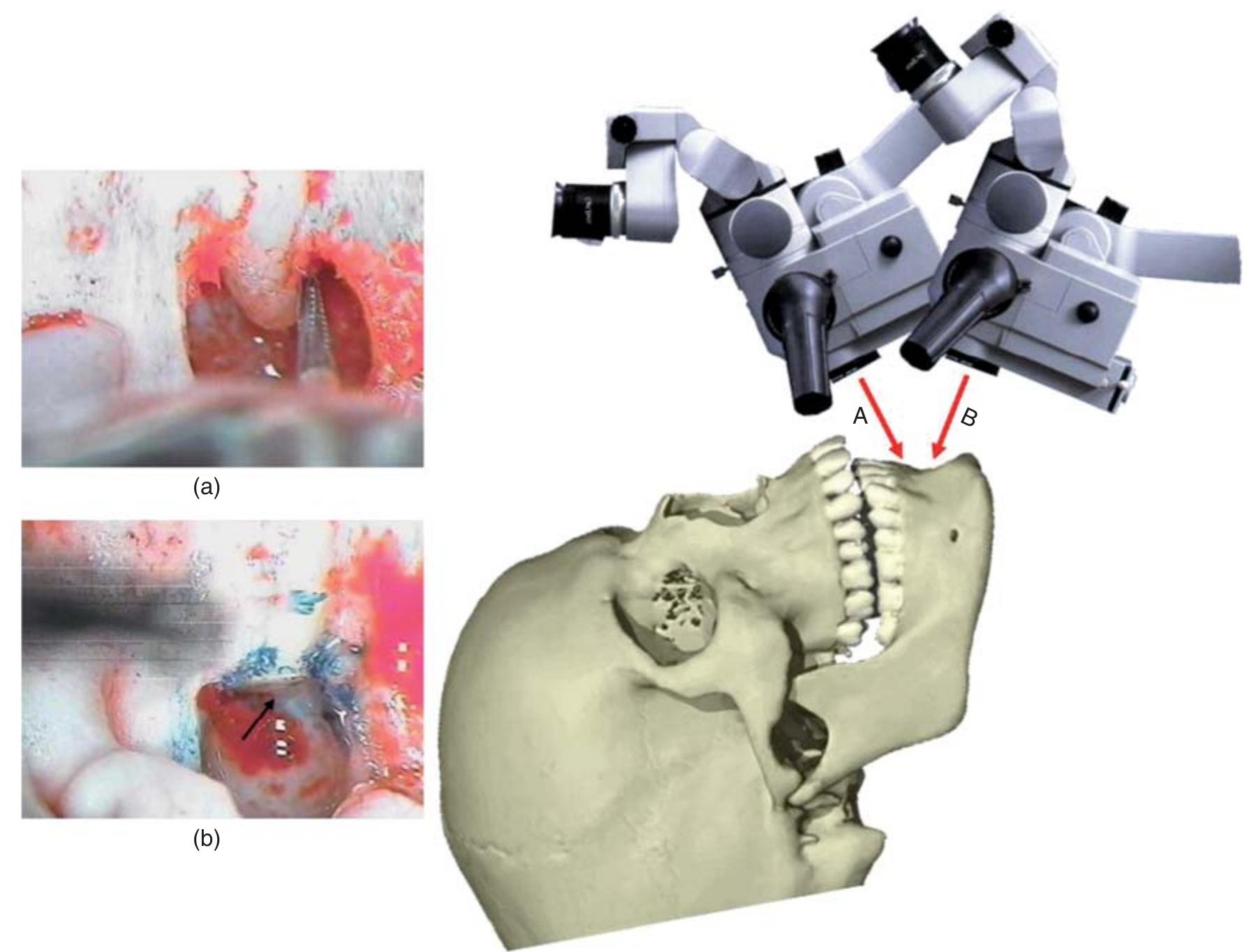 5 alignment for mandibular anterior teeth. the long axis of