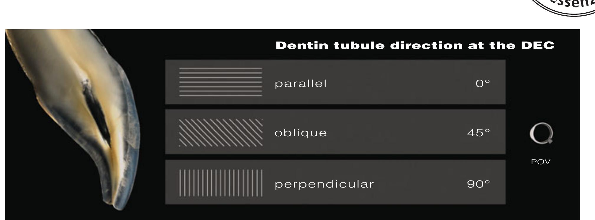 Translucent Dentin Figure 9 - from Bio-Emulation: biomimetically emulating