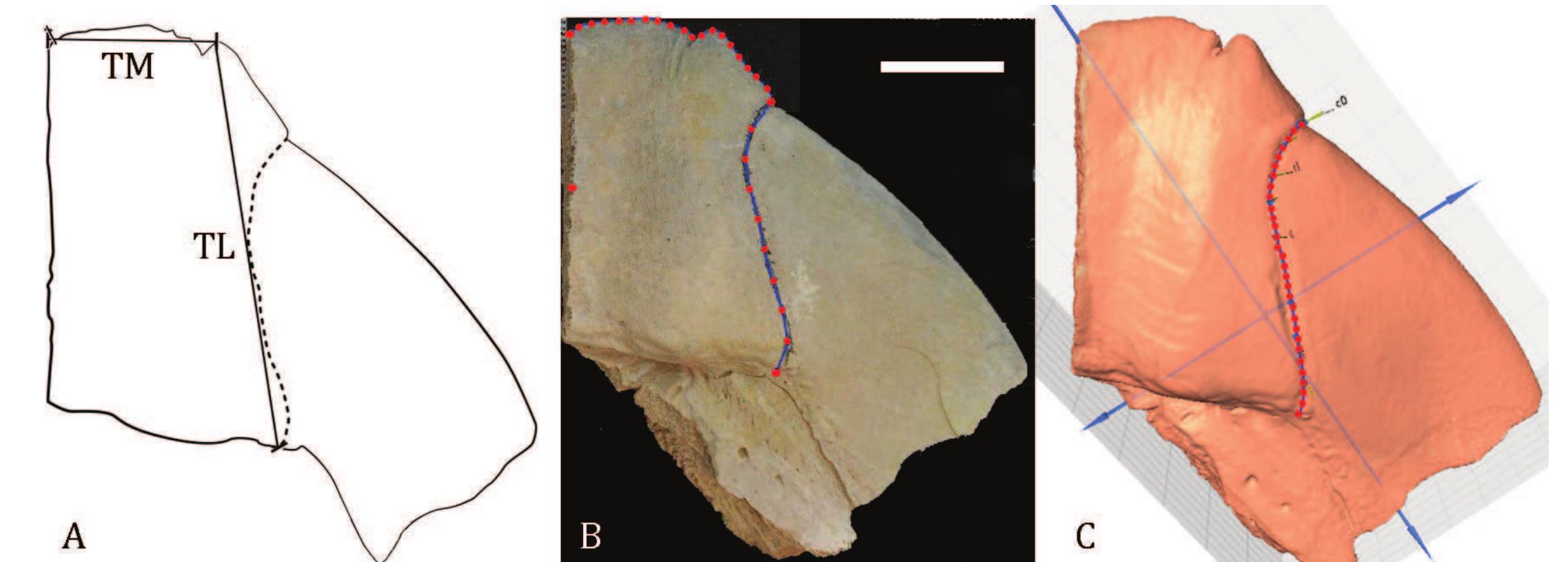 Figure 2. A. Standard linear measurements for quantifying the dimensions of the gular scale on the epiplastron of Echmatemys spe-  cies depicted on UMNH.VP.27220. TM=tooth-midline: Distance between the epiplastral tooth and the anatomical midline. TL=tooth-lip: Distance between the epiplastral tooth and the caudal lip of the gular-humeral sulcus. B. Two-dimensional epiplastral landmarks and semilandmarks used in 2D geometric morphometric comparisons of this study: Ventral surface. Data points were digitized from digital photographs. C. Three-dimensional epiplastral landmarks and semilandmarks used in 3D geometric morphometric analyses in this study. All data points were obtained from 3D NextEngine laser scans. Scale bar=2 cm. 