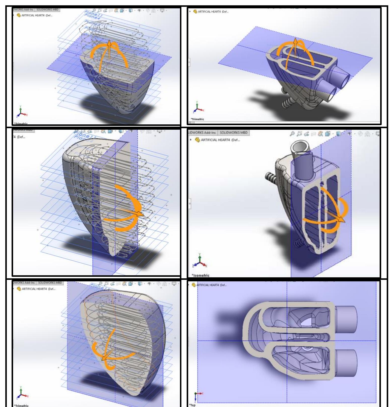 (PDF) Design and Modeling of a Soft Artificial Heart by Using the ...