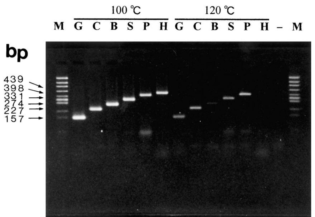 Agarose gel electrophoresis of pcr products amplified from