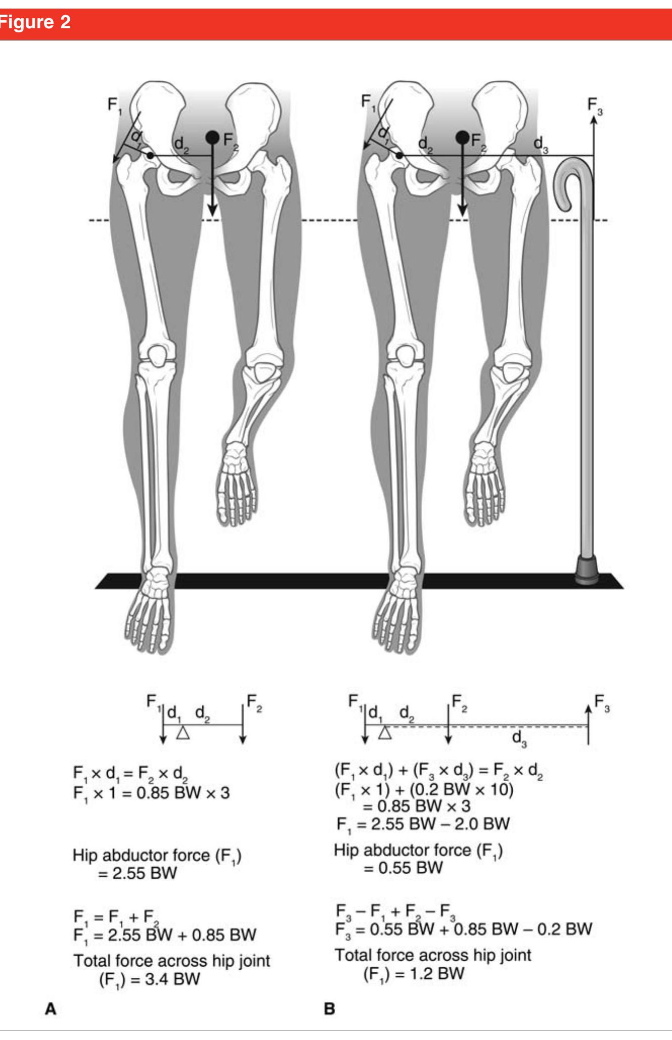 Figure 2 - from Ambulatory Assistive Devices in