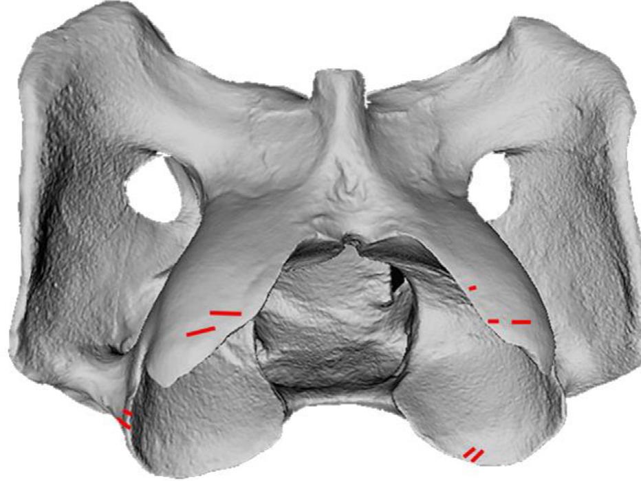 Fig. 5. Aggregate cut marks found on the C1, or atlas vertebra, in the DSK sample (ventral view). Elongated, transverse cut marks along the cranial side may relate to throat-slitting or disarticulation, while others likely relate to disarticulation. 