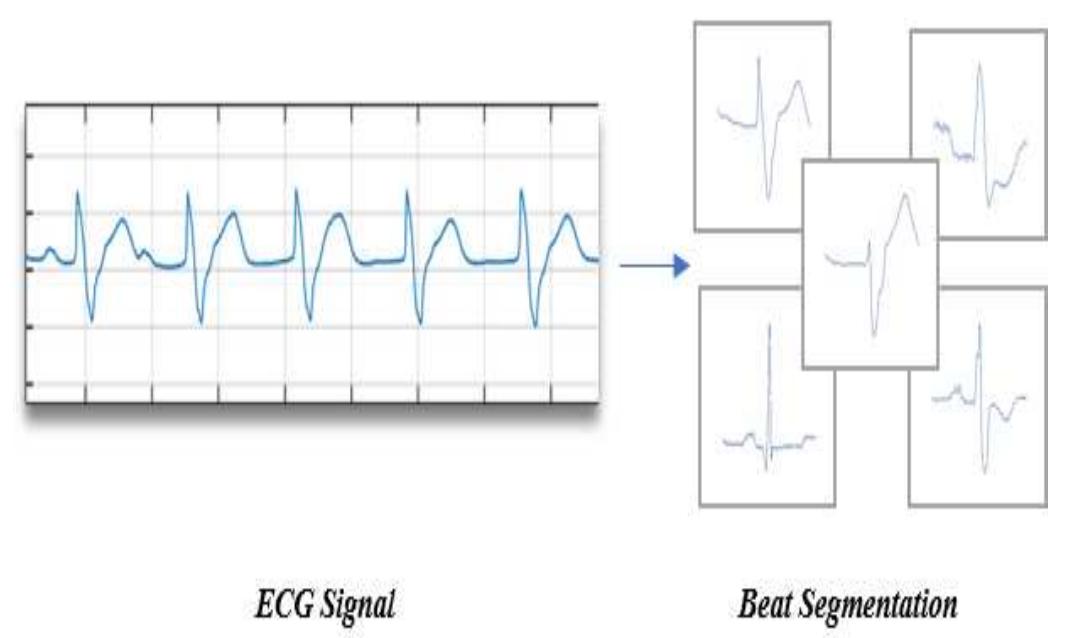 (PDF) Cardiac Arrhythmia Detection from 2D ECG Images by Using Deep ...