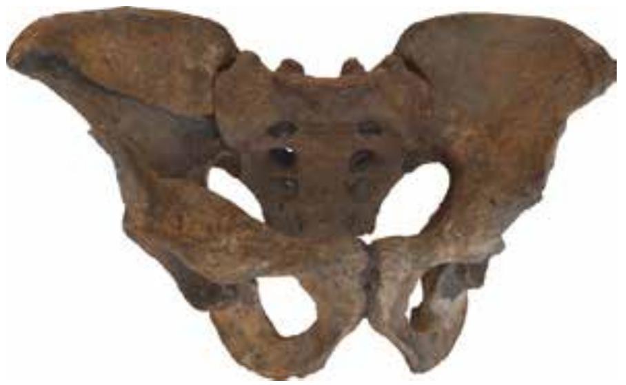 Fig.44 Photogrammetric 3D model of a Bronze Age pelvis from Hainburg, Austria (L. Waltenberger)  Marlon Bas’ PhD project Macro and micro-wear in the developing juvenile dentition: diet and masticatory mechanics in past populations aimed to gain insights into the diet of children at our case study sites. He developed a dental macrowear and microwear quantification methodology us- ing occlusal surface curvature descriptors for the purpose of childhood paleo-dietary reconstruc- tion. Data collection included using 3D intra-oral scanning and confocal microscopy of dentitions from Bronze-Age children, as well as medieval children for comparison. 