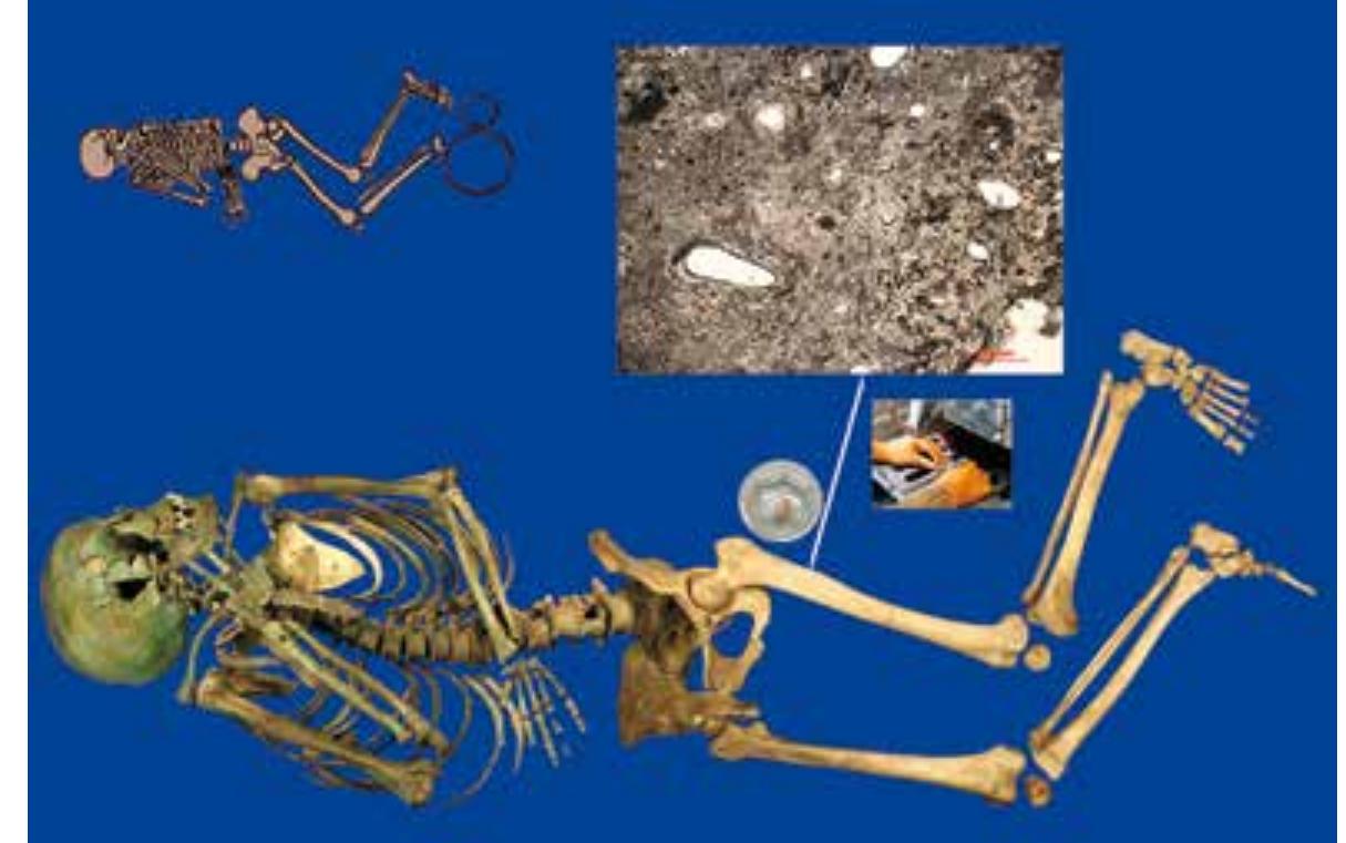 Fig. 80 Top left: sketch of Gemeinlebarn A, Grave 215 (after Szombathy 1929, fig. 33), bottom: reconstruction of skeleton as found in the grave, anthropological collection, NHM, Vienna (photos and graphics: E. Weiss-Krejci); centre: thin section production and microscopic analysis (photos and micrograph: K. Mandl)  Following the acceptance of the book proposal ‘Interdisciplinary Explorations of Postmortem Agency: The Uses of Dead Bodies, Funerary Objects, and Burial Spaces through Time’ by Springer Nature, the editors Estella Weiss-Krejci, Sebastian Becker and Philip Schwyzer start- ed to prepare the book. This volume is one of the main outputs of the DEEPDEAD-project and 