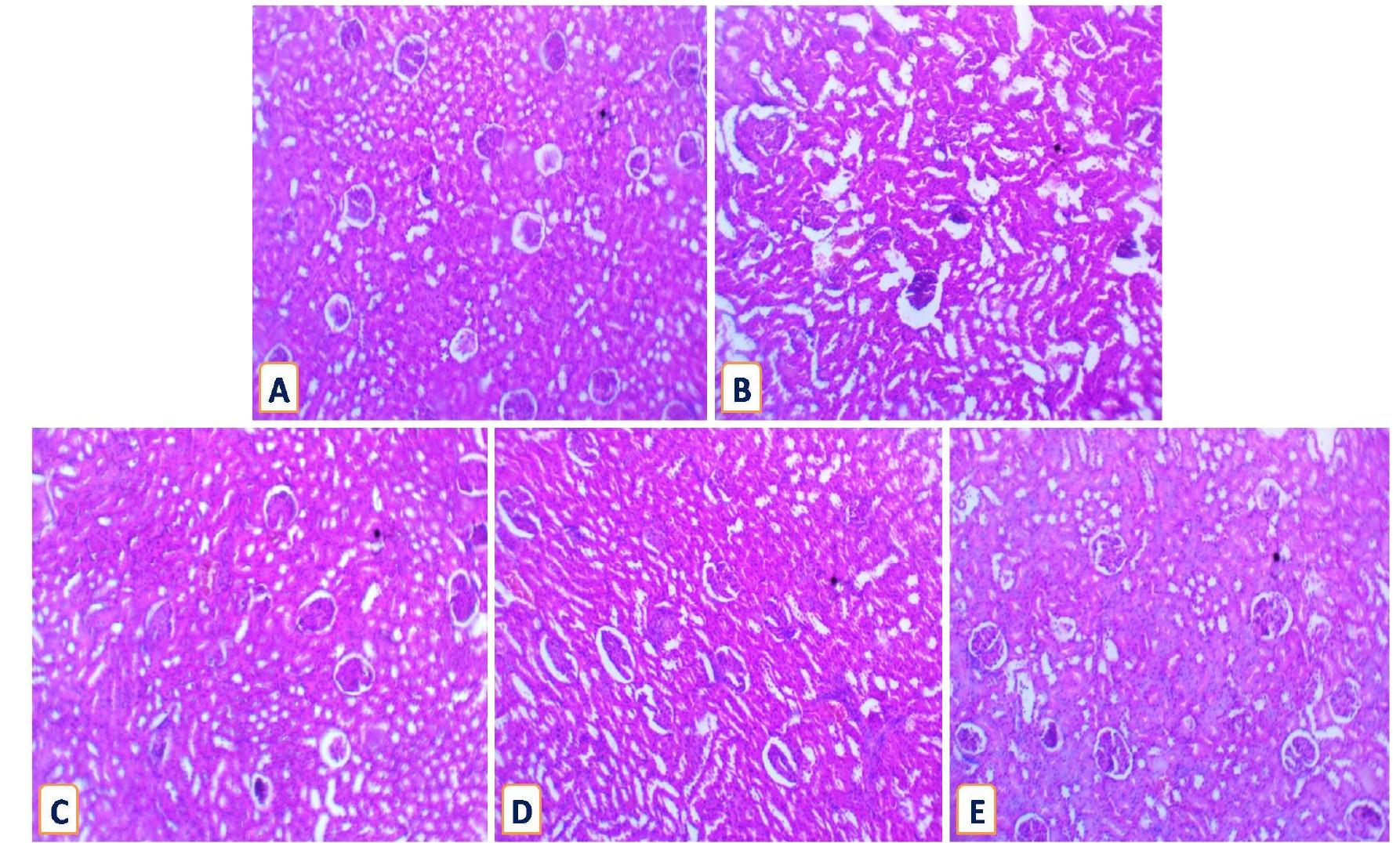 Representative photomicrograph of renal tissue showing