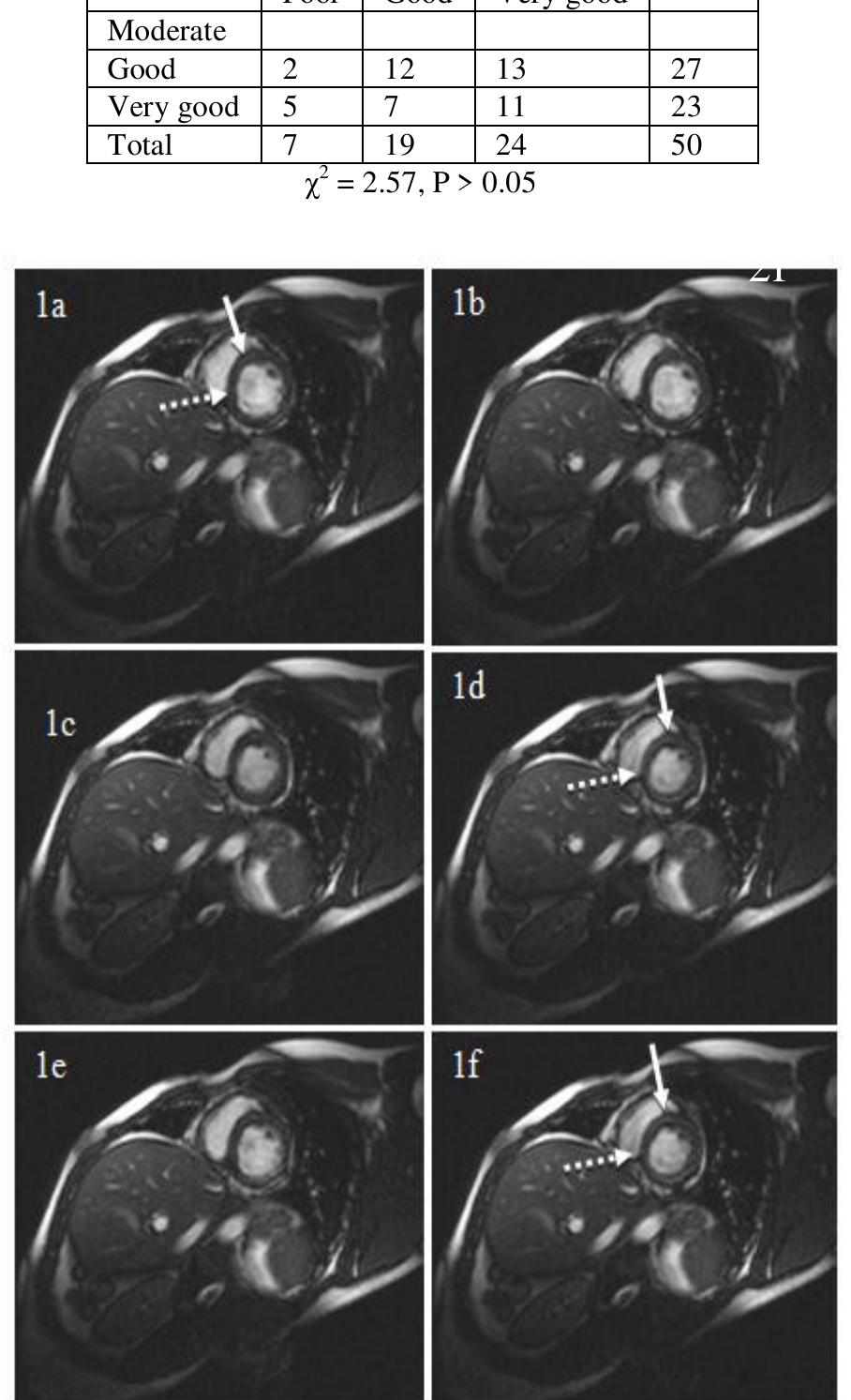 (PDF) Comparative Assessment of Wall Motion Score Index and Left ...