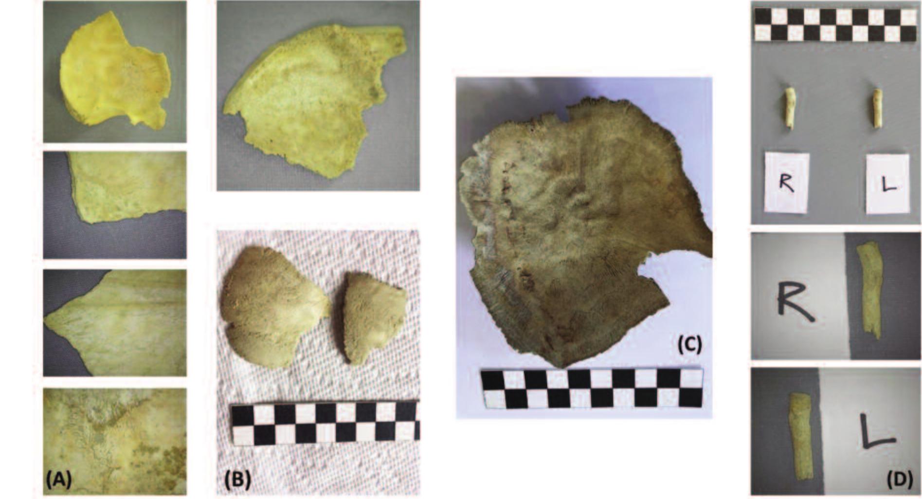 Fig. 7. (A) Burial 55, showing endocranial lesions. (B) Burial 57, showing periosteal reac- tion in the form of cribra orbitalia (top) and porotic hyperostosis (bottom). (C) Burial 58, showing signs of a possible inflammatory reaction on the endocranial surface. (D) Burial 59, showing signs of possible trauma on the left and right radial tuberosity where the bi- ceps brachii tendon inserts (image by D. Pickel 2019). 