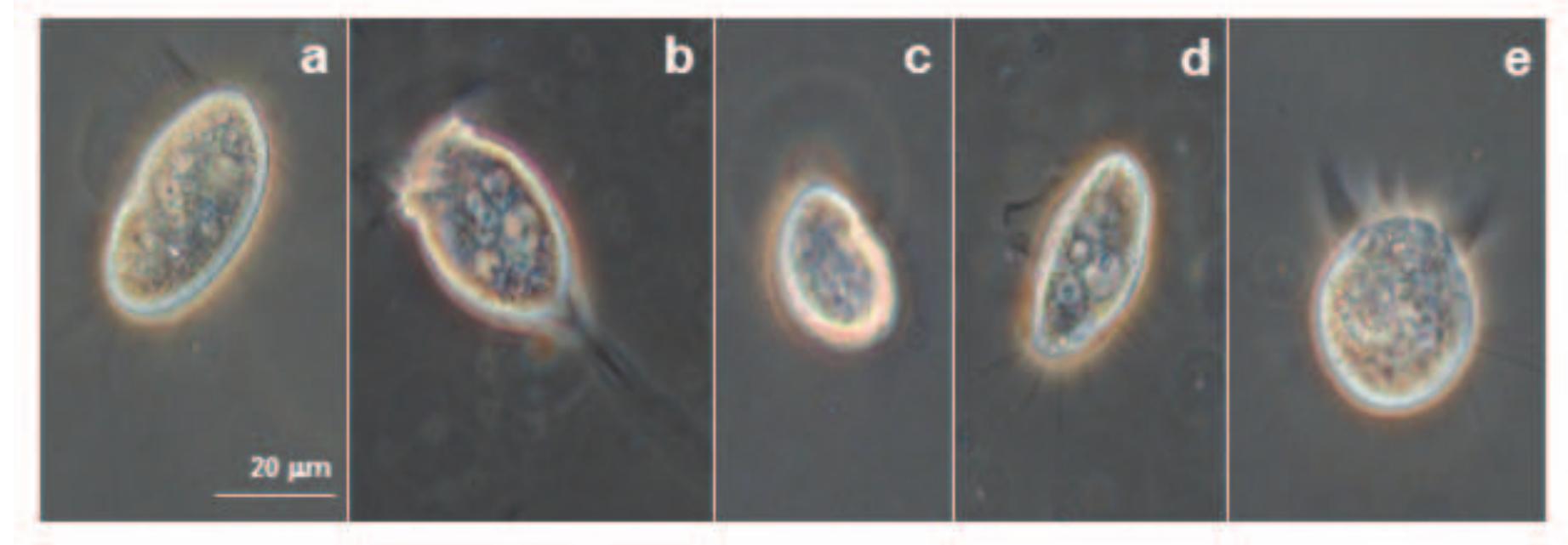 Figure 6. Micrographs of some representative ciliates in the granitic rock pools. a) Homalogastra setosa, b) Vorticella aquadulcis, c) Colpoda steinii, d) Cyclidium glaucoma, e) Halteria grandinella. Micrografias de algunos de los ciliados representativos de las pilas graniticas. 