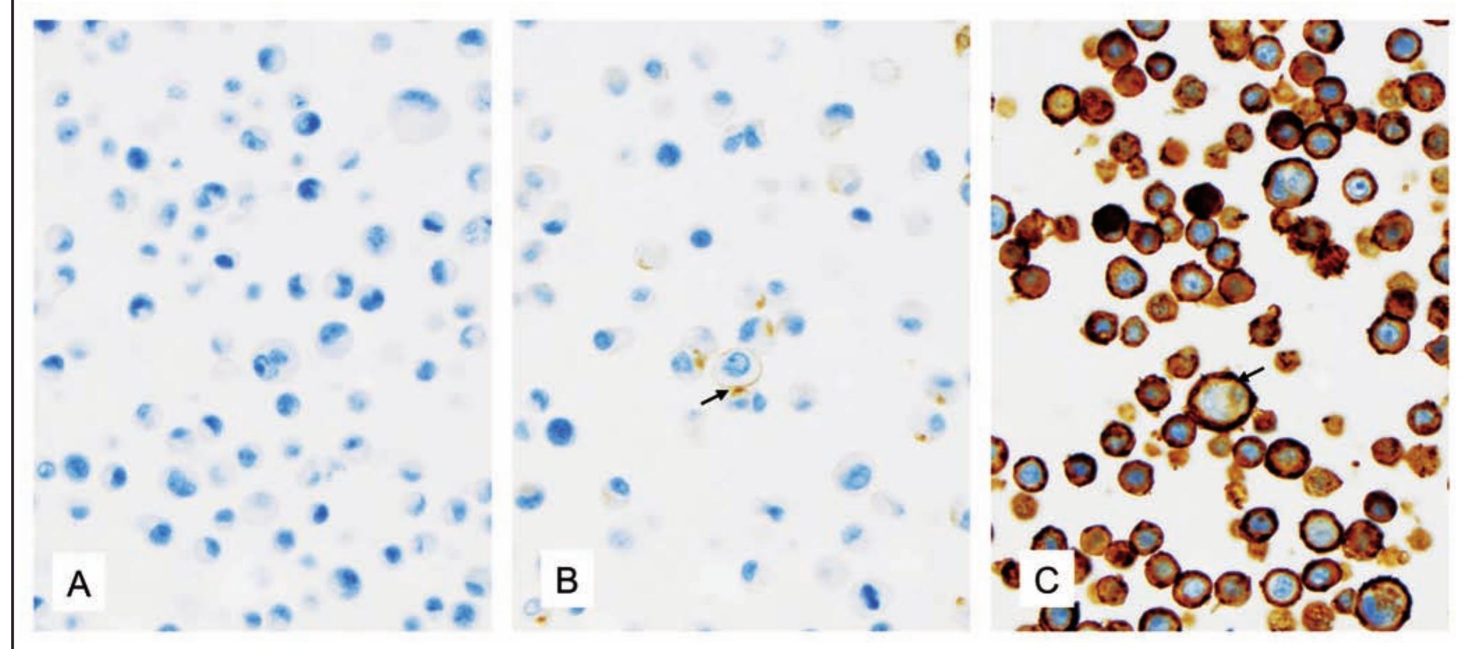 (PDF) Standardized Assessment of the HER2 Status in Breast Cancer by ...