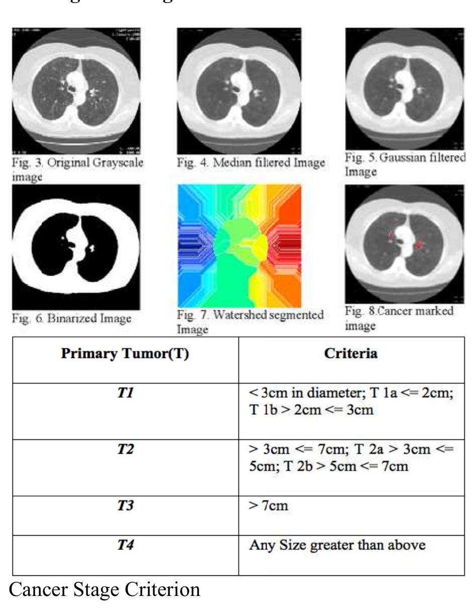(PDF) A REVIEW OF COMPUTER AIDED DIAGNOSIS (CAD) SYSTEMS FOR DETECTION ...