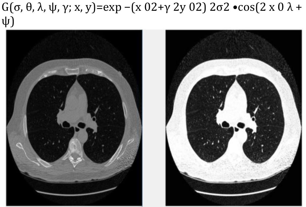 (PDF) Lung Cancer Detection using Matlab Image Processing Techniques