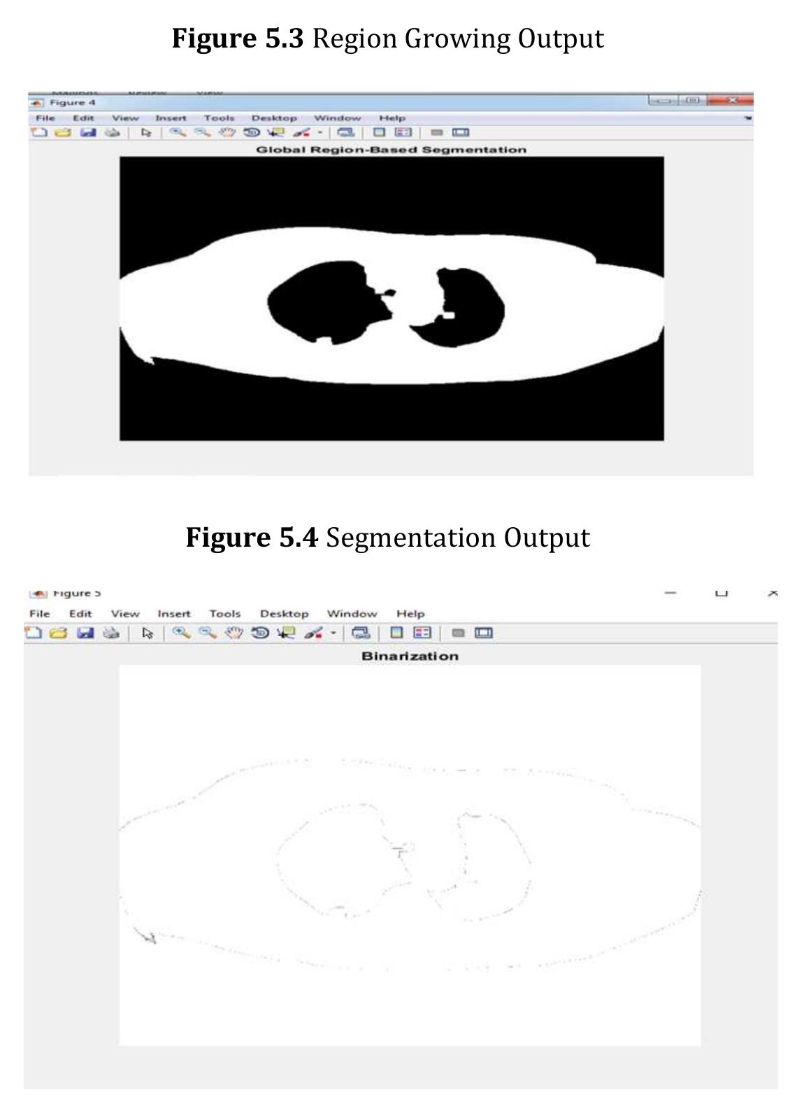 (PDF) Lung Cancer Detection using Matlab Image Processing Techniques