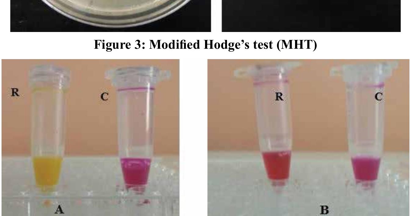 Only 5 A. baumannii (22.7%) isolates were able to yroduce the carbapenemase enzyme when detected by MHT and all the remaining isolates were carbapenemase 1egative (Table 2).  Table 2: Comparison of different methods for 