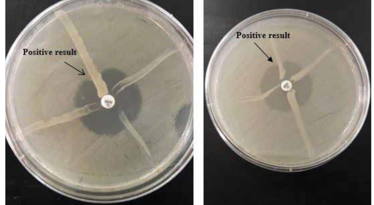 Figure 3: Modified Hodge’s test (MHT) 