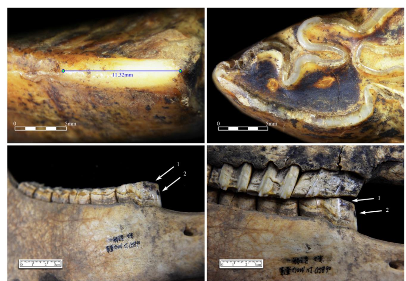 Fig. 8. (Top) Enamel/dentine exposure on the left lower second premolar of horse 7. (Bottom) Enamel/dentine exposure on the right lower second premolar of horse 3: occlusal bevel (arrow 1) and distinct black-colored shallow chip on the anterior surface of the tooth (arrow 2). See S/ Appendix, Fig. $3 for a close- up of the shallow chips. 