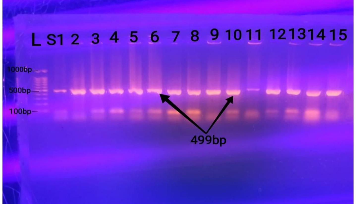 Figure 1: Ethidium bromide stained Agarose Gel Electrophoresis (1.2%) of PCR Amplified products from extracted of the DNA of CoNS isolates and amplified with the primer of (mecA) gene (499 bp). Lane L: Ladder (1000-bp ladder), all CoNS isolates (Lanes S1, 2,3,4,5,6,7,8,9,10,11,12,13,14, and 15) are mecAgene positive.  Discussion 