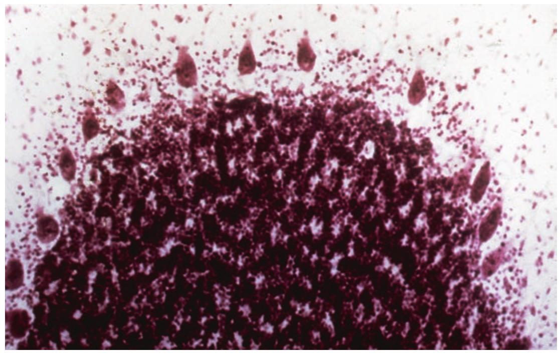 PDF) Prion Diseases Neuromethods 129