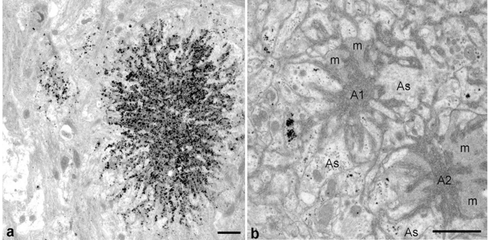 PDF) Prion Diseases Neuromethods 129